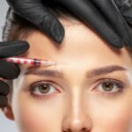 Botox: a revolução dos tratamentos estéticos